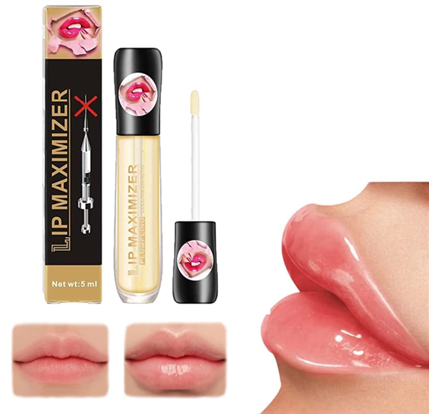 Ser Volum Buze Hyaluronic